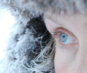 Frozen eyes