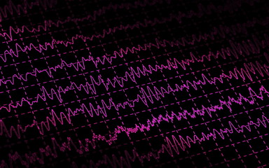 brain wave EEG isolated on black background