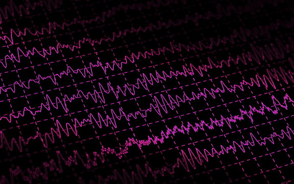 Brain Wave EEG Isolated On Black Background