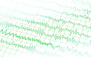 green graph brain wave EEG isolated on white background