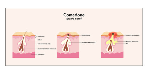 Ampolle di vitaskin di unantiacne
