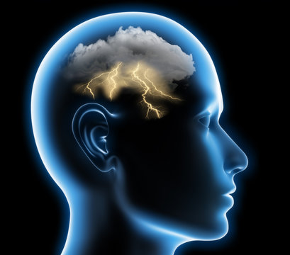 Migr&auml;ne - Gewitter im Kopf 2