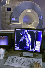 Magnetic resonance imaging