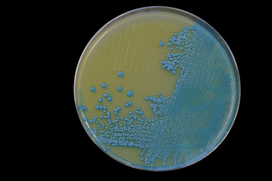 Listeria Bacteria growing on an agar plate.