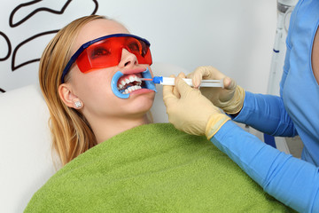 during the process of teeth whitening