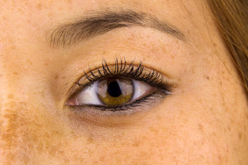 Obraz premium Sun Damaged Skin
