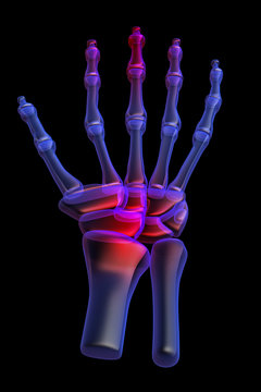 3d human hand pain