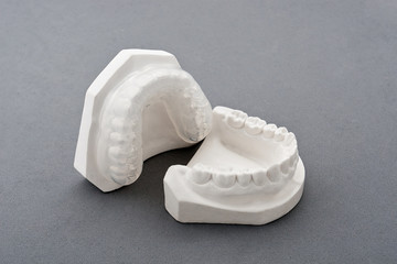 Dental plaster mold