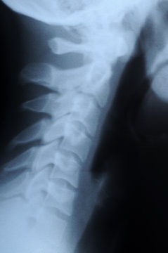 radiograph of human neck