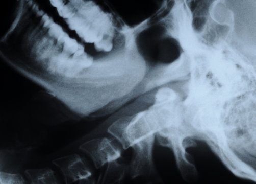 radiograph of human neck