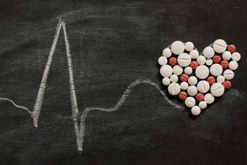 ekg