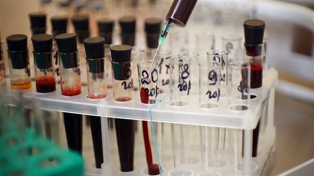 blood analysis