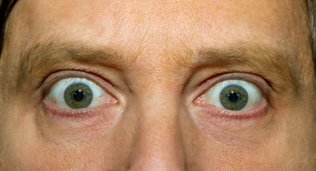 Starrende Augen