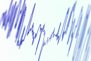Audio, seismic or stock market wave diagram