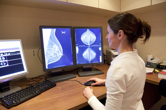 Radiology technician looking at mammography