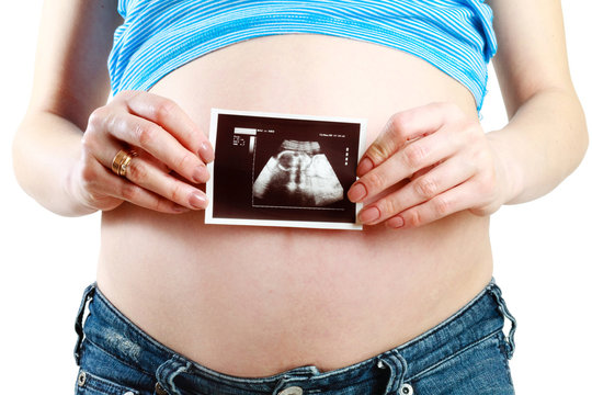A pregnant woman is holding her Ultrasound.