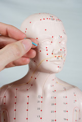 Sanfte Akupunktur Kurs