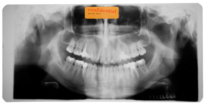 x-ray of head