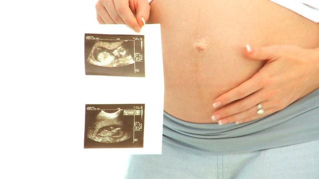 Expecting woman holding a scan