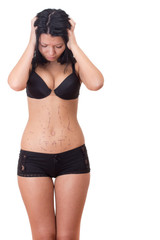 Fototapeta premium Girl stressed before plastic surgery
