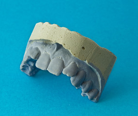 Teeth plaster model