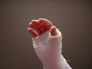 Injured hand with cast