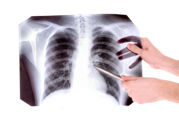 X-Ray Image of chest isolated on white. Showing something with p