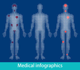 Medical infographics