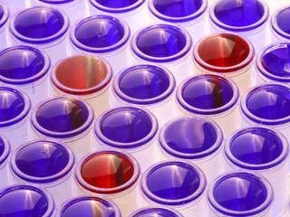 Positive Proben in medizinischer Probenanalytik