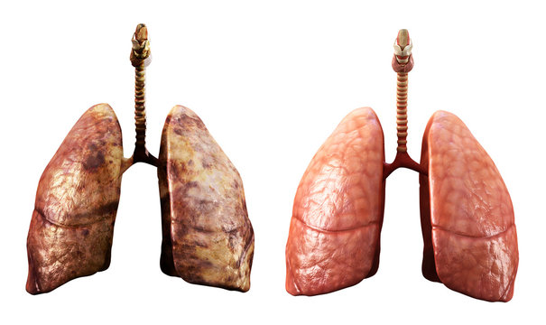 healthy and rotten  lungs