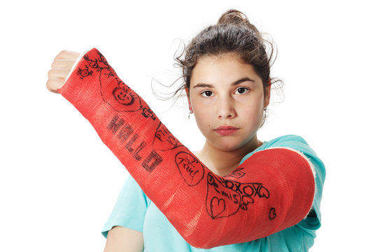 M&auml;dchen mit rotem Gipsverband
