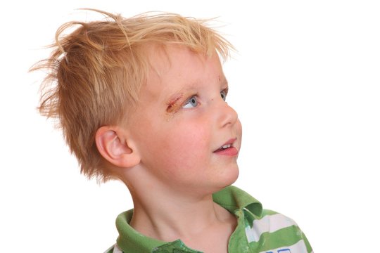 Verletzter Junge