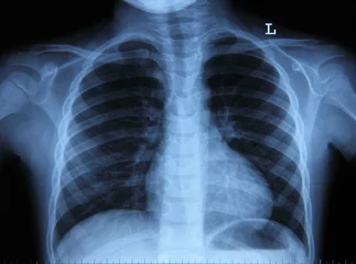 Pulmonary Radiography © Marco Desscouleurs