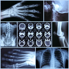 Radiography