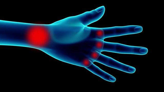 hand with problems