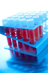 Blood samples