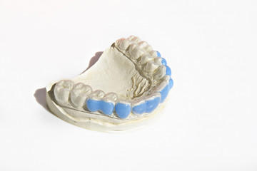 Stampino in gesso con mascherina in silicone