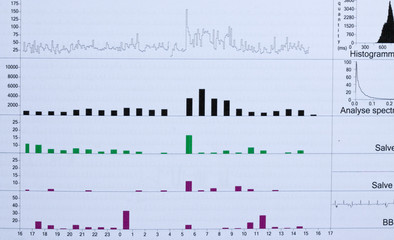 électrocardiogramme, graphiques tests d'effort
