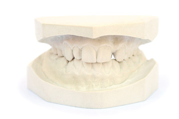 Teeth gypsum model © RUZANNA ARUTYUNYAN