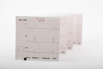 cardiogram