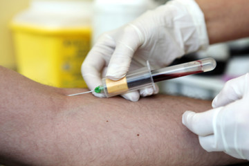 Blood Test