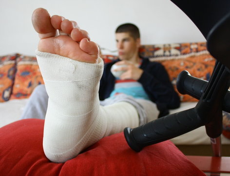 jambe pl&acirc;tr&eacute;e et b&eacute;quilles