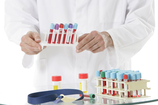 Sang et urine à analyser