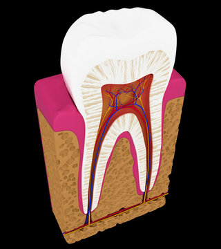 Tooth cut or section isolated