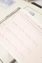 心電図のグラフ