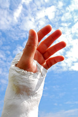 Linke Hand in Gips