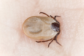 Tick feeding on human, extreme close up