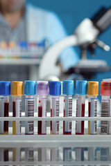 tray with tubes with blood samples
