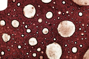 Cancer Cells