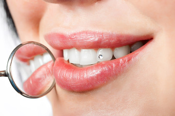 dental mouth mirror near healthy white woman teeth - 34394889